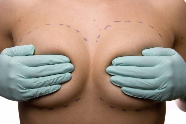 3 Tips to Prepare for Breast Augmentation Surgery Recovery